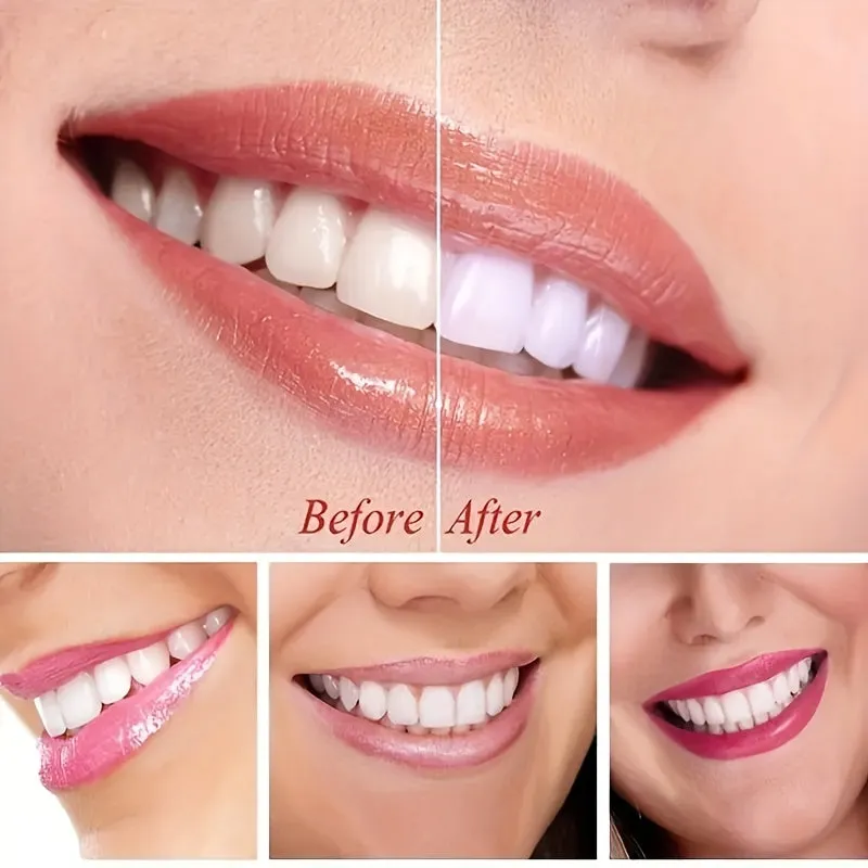 1Week Tooth Whitening Serum for Plaque and Stains 035oz