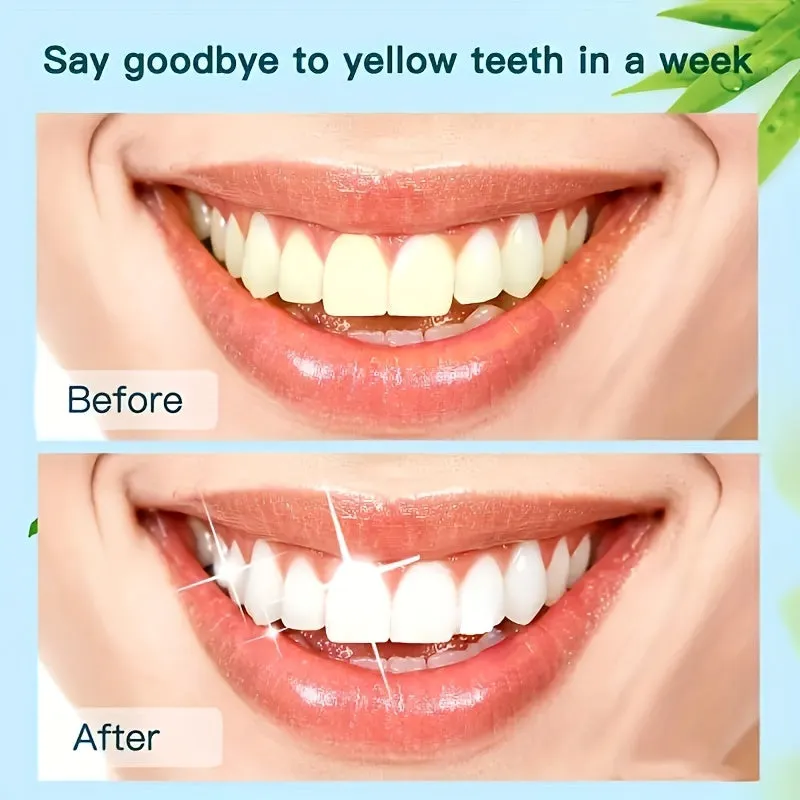 1Week Tooth Whitening Serum for Plaque and Stains 035oz